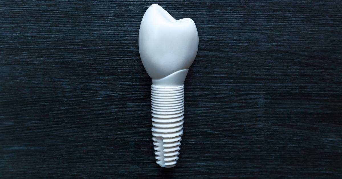 ceramic vs titanium implants